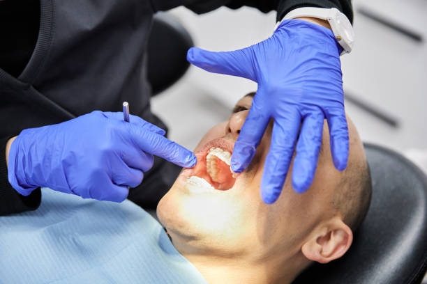 Best Emergency Dentist for Knocked-Out Tooth in Four Cners, OR