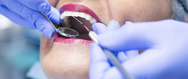 Best Emergency Dental Care for Abscessed Tooth in Four Cners, OR
